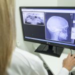 UWAGA NOWE SZKOLENIE !!! – Ochrona radiologiczna pacjenta dla osób wykonujących badania, zabiegi lub leczenie z zastosowaniem promieniowania jonizującego